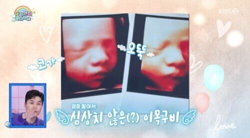 Жирэмсэн Nam Bo Ra хүүхдийнхээ төрхийг BTS-ийн V-тэй холбон тайлбарлажээ 2 Жирэмсэн Nam Bo Ra хүүхдийнхээ төрхийг BTS-ийн V-тэй холбон тайлбарлажээ