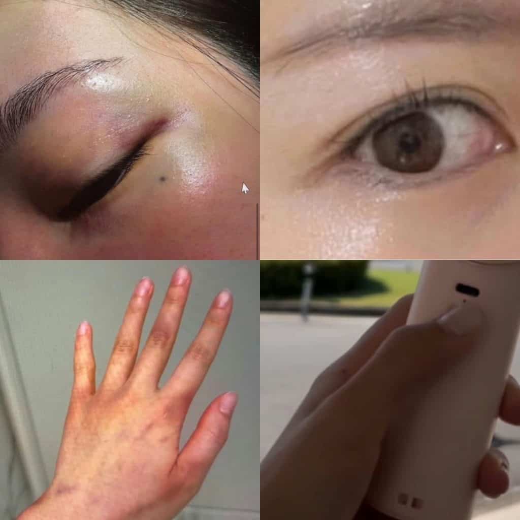 BLACKPINK-ийн Jisoo-гийн ахын эхнэр салалтаа зарлаж, гэр бүлийн хүчирхийллийн маргаан дахин сөхөгдөв 2 BLACKPINK-ийн Jisoo-гийн ахын эхнэр салалтаа зарлаж, гэр бүлийн хүчирхийллийн маргаан дахин сөхөгдөв